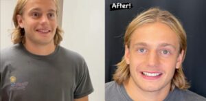 Before and after of a patient
